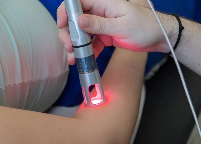 Terapia ILIB laser: como escolher a clínica certa?